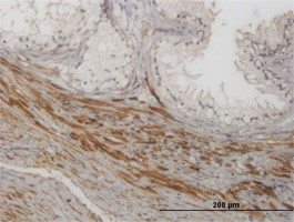 NKIRAS1 Antibody (monoclonal) (M01)