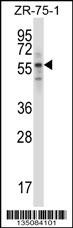 Mouse Rps6kb1 Antibody