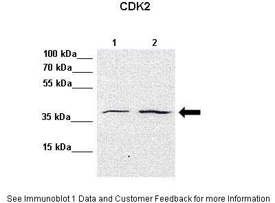 CDK2 (Phospho Thr160) Antibody