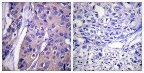 C-RAF (Phospho-Ser296) antibody