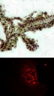 Akt (phospho Thr308) Antibody
