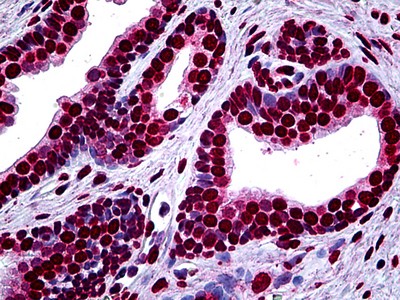 MEF2A Antibody