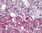 NTRK1 Antibody