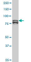 MTA1 Antibody (monoclonal) (M01)