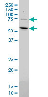 MEF2D Antibody (monoclonal) (M04)