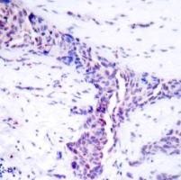ATF2 Antibody