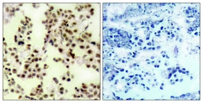 p73 (Phospho-Tyr99) antibody