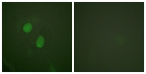Estrogen Receptor-alpha (Phospho-Ser305) antibody