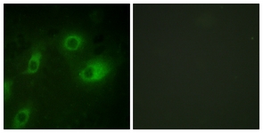 Keratin 18 (Phospho-Ser52) antibody