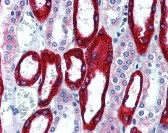 KRT19 Antibody