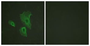 BCL-2 (Phospho-Thr69) antibody