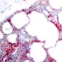ATF2 (phospho Ser62 / 44) Antibody