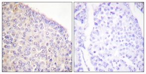 SYK (Phospho-Tyr525) antibody