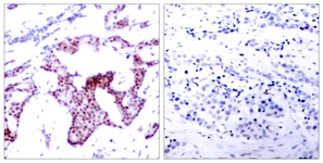 NF-kappaB p65 (Phospho-Ser276) antibody