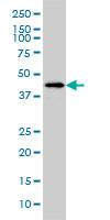 LW-1 Antibody (monoclonal) (M01)