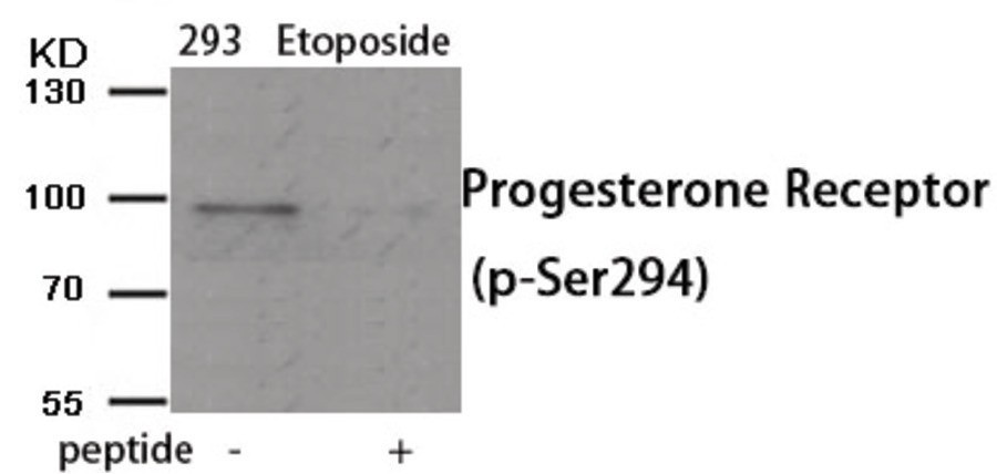 Progesterone Receptor (phospho Ser294) Antibody