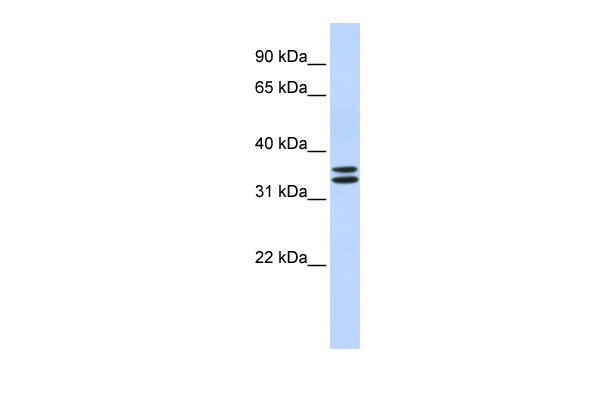 TAL1 antibody