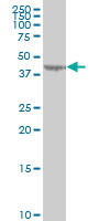 LYPLA3 Antibody (monoclonal) (M01)