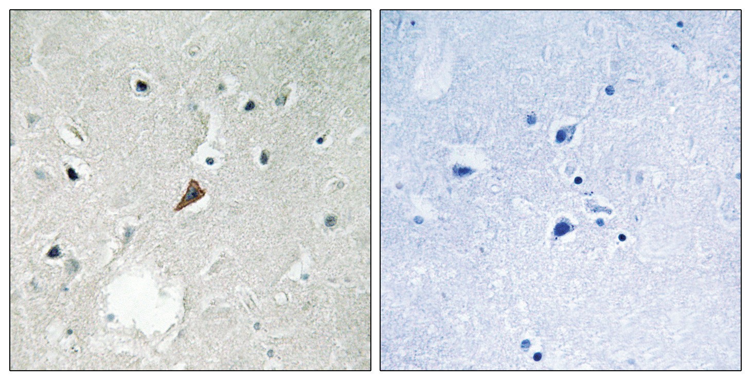 PYK2 (phospho Tyr579) Antibody