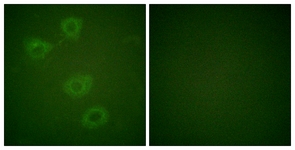 Tyrosine Hydroxylase (Phospho-Ser19) antibody