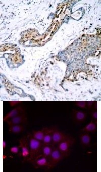 Estrogen Receptor a (phospho Ser118) Antibody