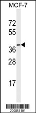 MAPK15 Antibody (Ascites)