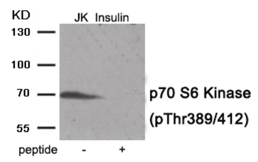 p70 S6 Kinase (phospho Thr389/412) Antibody