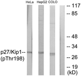 p27 Kip1 (Phospho-Thr198) antibody
