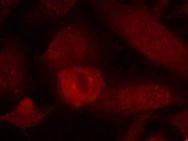 IRS 1 Antibody