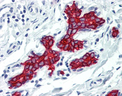 Cytoke Antibody