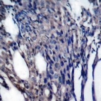 IkB a (phospho Tyr42) Antibody