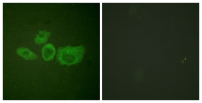 Tyrosine Hydroxylase antibody
