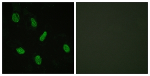 Androgen Receptorantibody