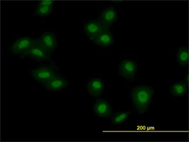 MKRN2 Antibody (monoclonal) (M01)