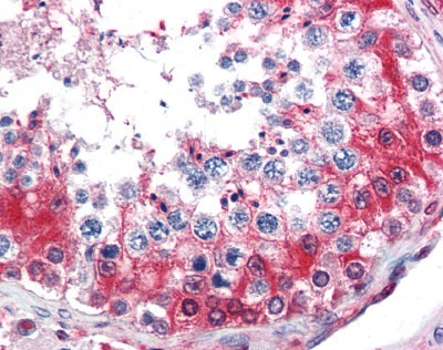 GAPDH Antibody