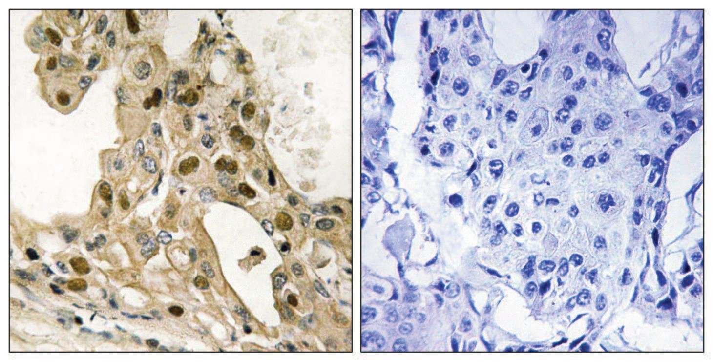 p53 (phospho Thr387) Antibody