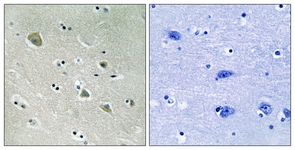 PAK1 (Phospho-Ser204) antibody