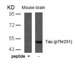 Tau (phospho Thr231) Antibody