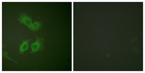 Amyloid beta A4 antibody