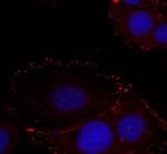 FAK (phospho Tyr576 / Tyr577) Antibody