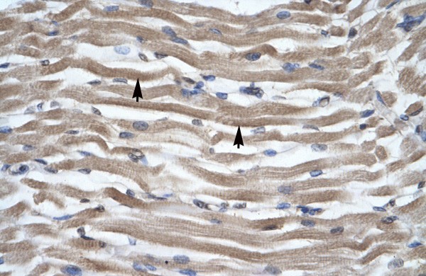 DLX2 antibody