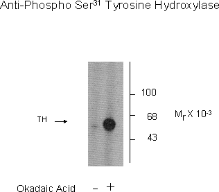 Tyrosine Hydroxylase (phospho Ser31) Antibody
