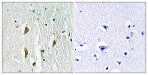 PAK1/2/3 antibody