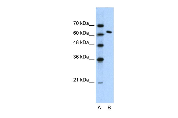 SUPT16Hantibody - N-terminal region