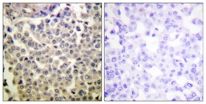 PAK1/2/3 (Phospho-Thr423/402/421) antibody