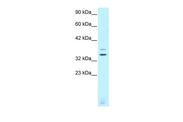 CHX10 antibody