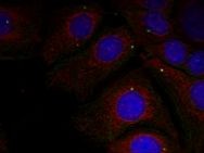 a Synuclein (phospho Tyr125) Antibody