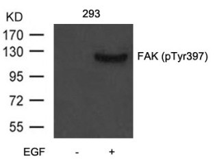 FAK (phospho Tyr397) Antibody