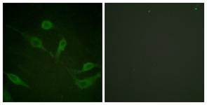 Keratin 18 (Phospho-Ser33) antibody