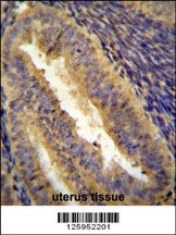 JUN Antibody